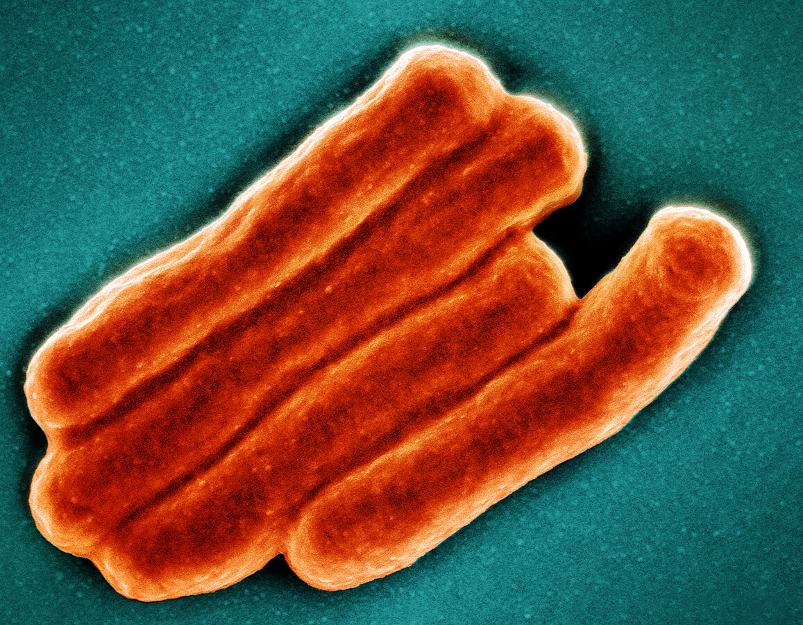 Mycobacterium tuberculosis