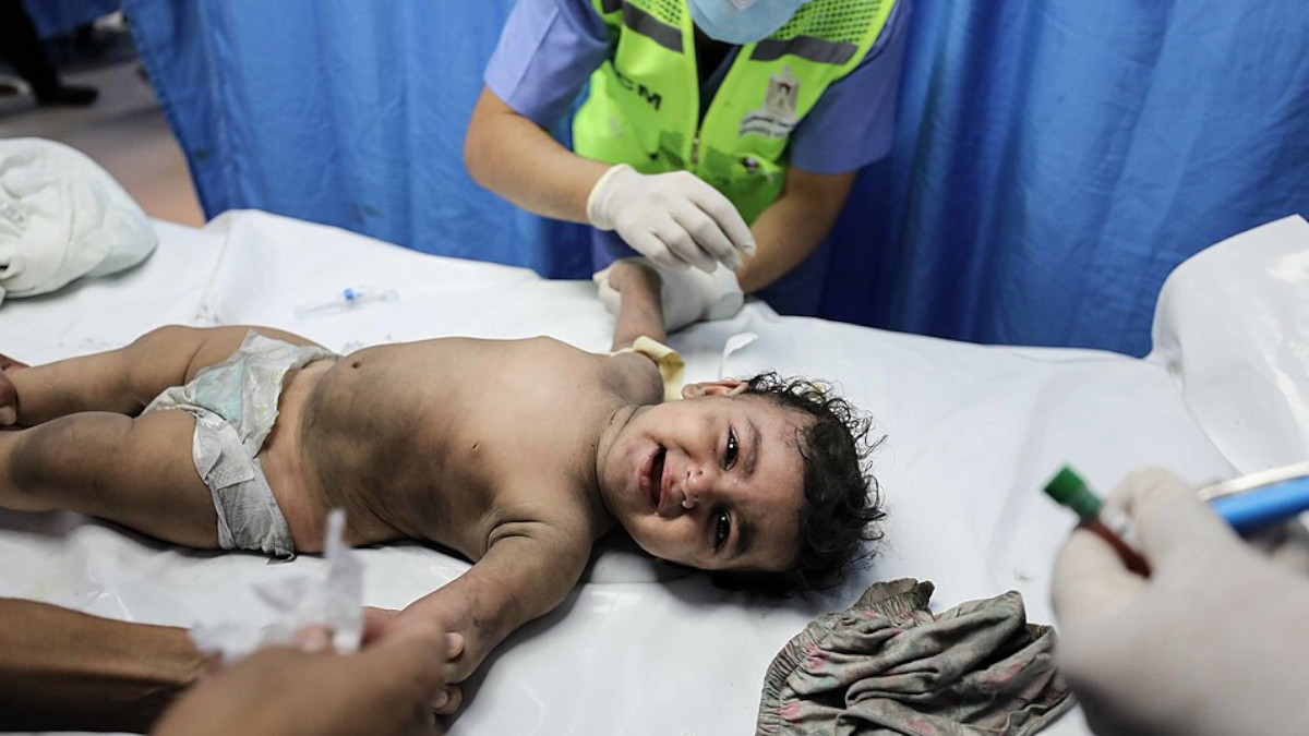 verletztes Kind in Gaza